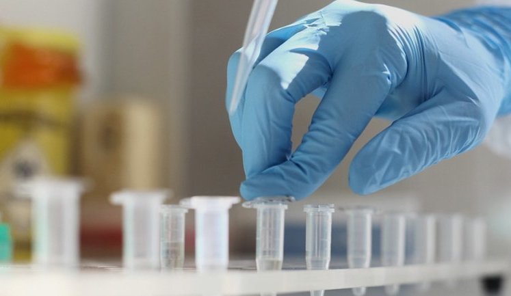 First Covid-19 case spotted in Chernihiv region