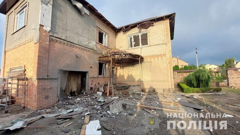 Рашисты обстреляли 6 населенных пунктов Донетчины. Есть убитые и раненые, - Нацполиция 11