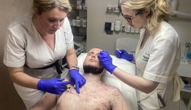 Wounds treated for 5 hours and put for more than 150 stitches: how to erase "marks of war"