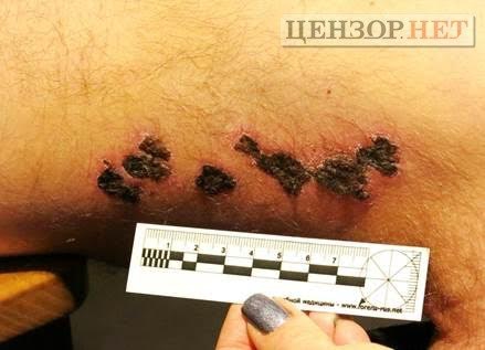 майдан ранение