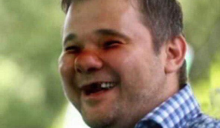Глава ОП Богдан виклав свою фотографію з вибитими зубами і синцями