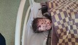 "Русский мир" такий: Сєверодончанка та двоє її дітей-близнюків постраждали внаслідок обстрілів військ РФ. ФОТОрепортаж