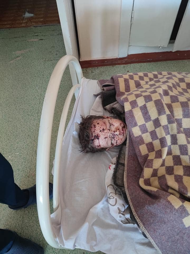 Русский мир такий: Сєверодончанка та двоє її дітей-близнюків постраждали внаслідок обстрілів військ РФ 01