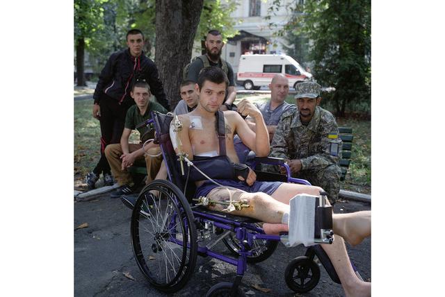 Проект українського фотографа Чекменьова зі знімками поранених воїнів зібрав близько $ 400000 для їх лікування і підтримки 01