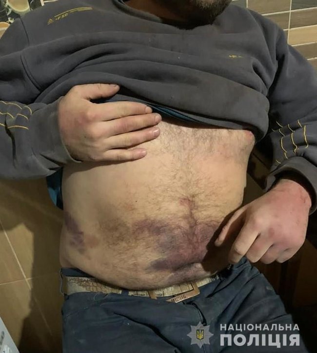 Троє чоловіків викрали, били битами і катували двох чоловіків, вимагаючи неіснуючий борг у 3 тис. доларів США, - поліція Вінниччини 02