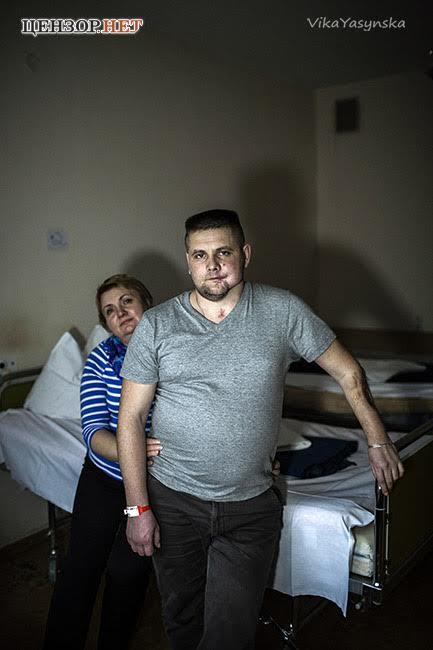 Я попрощався з життям. Коли прийшов лікар, я спитав у нього, чи я вже на тому світі? - важкопоранений боєць 80 бригади Андрій Усач 03