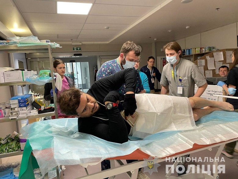 Життю пораненого в Ірпені американського журналіста нічого не загрожує, - Нацполіція 02