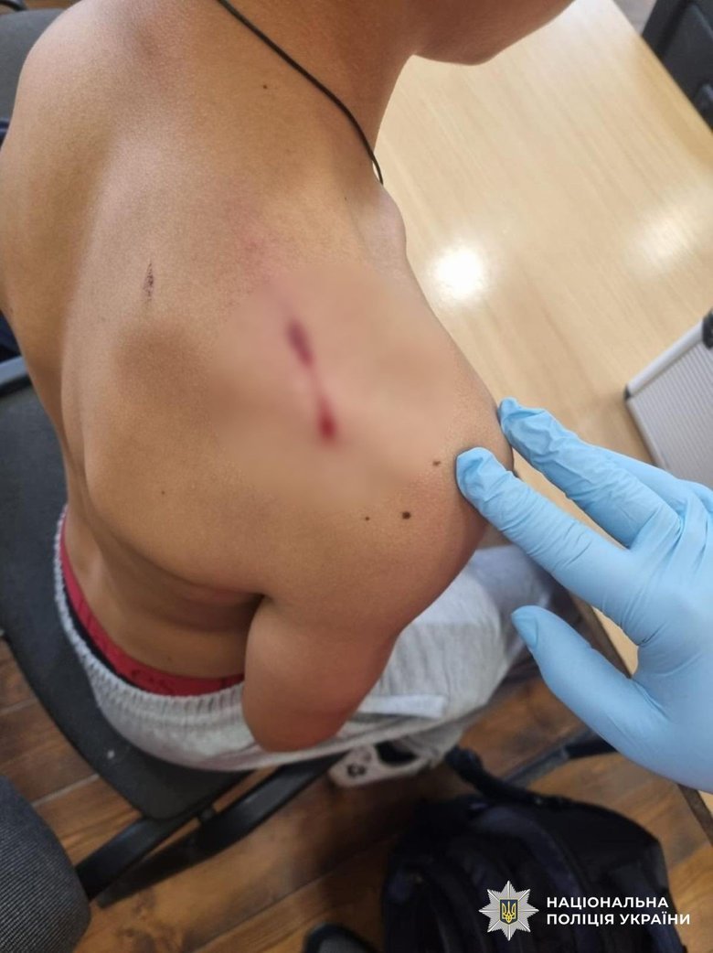 В Закарпатье 9-классник принес в школу пистолет и выстрелил в своего одноклассника