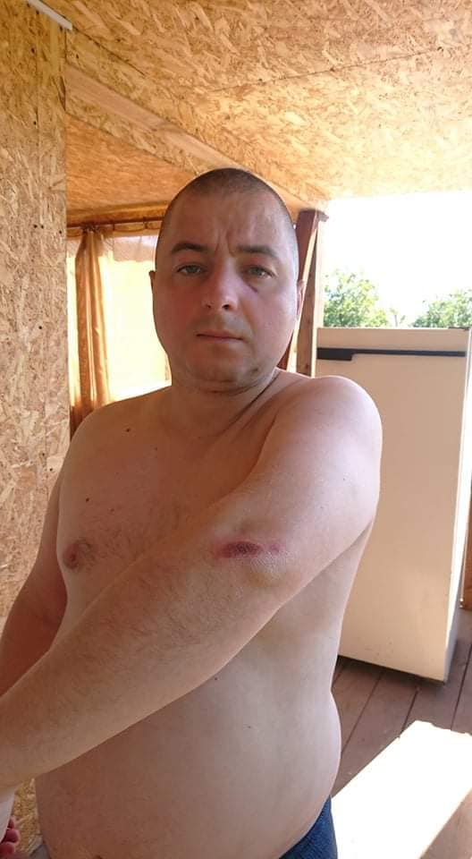 Група невідомих побила волонтера Кошовенка та його брата в Генічеську 01