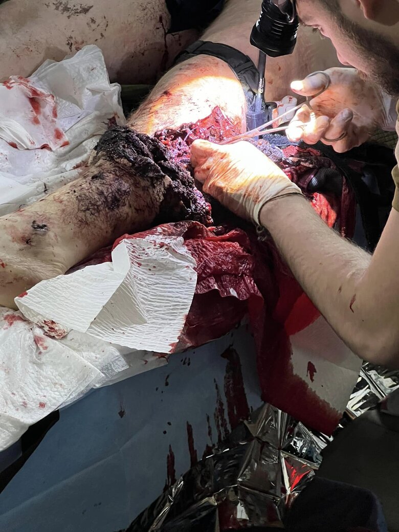 Муфтий Украины и воин-добровольец Исмагилов показал эвакуацию раненых из Бахмута: Россия должна прекратить свое существование. Прощения не будет 05