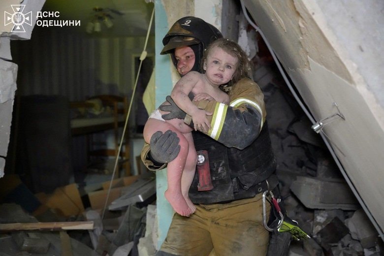 З лікарні виписали поранену в Одесі 2-річну дівчинку