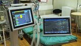 Україна має намір виробляти апарати ШВЛ спільно зі Швейцарією. У перспективі - нові можливості для експорту, - Стефанішина