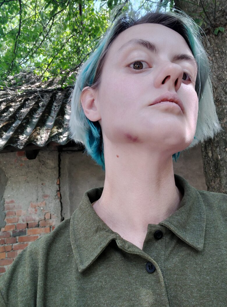 П’яний майор ТЦК в Ужгороді побив дружину воїна ЗСУ 05