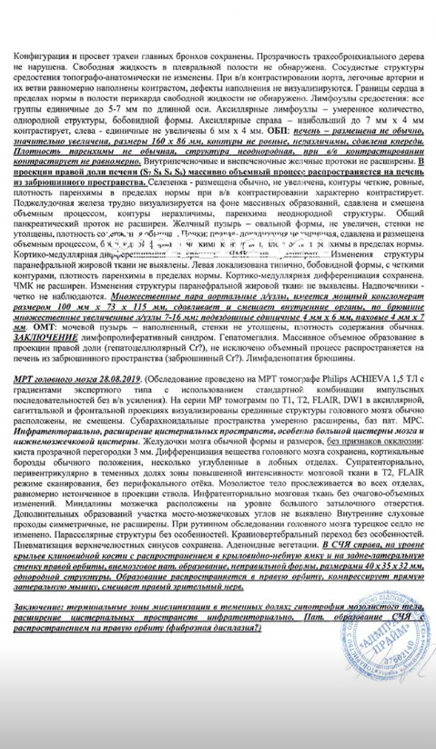 Полуторагодовалому Марьяну Коберскому нужна помощь в лечении онкозаболевания 03
