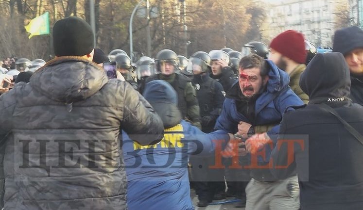 Под Радой пострадало 17 правоохранителей, одному из них, ветерану АТО подполковнику Кулинко планируют делать трепанацию черепа, - Нацполиция