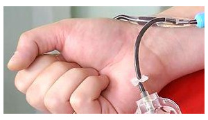 15 schoolchildren hospitalized with suspicion on hepatitis A in Chernihiv