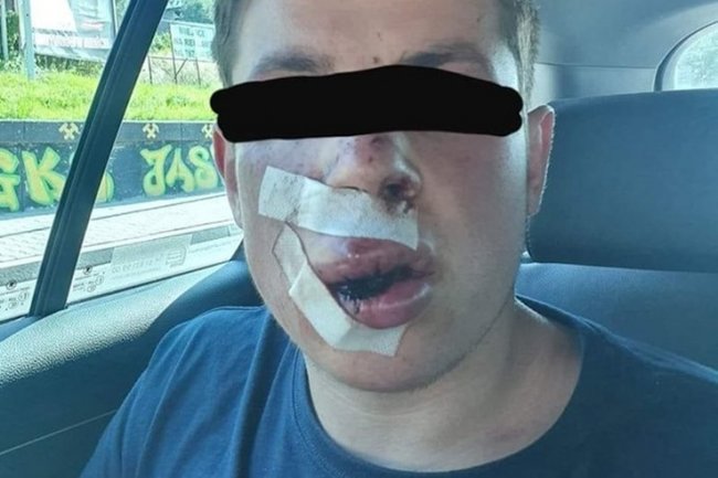 Невідомі жорстоко побили українського студента в Польщі 01