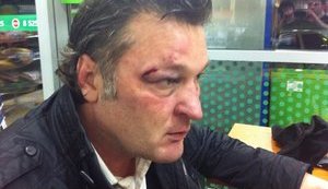 В Крыму похитили, ограбили и избили бизнесмена Балашова, который назвал Путина "безумным". ФОТО+ВИДЕО