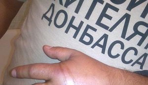 В Киеве подстрелили парня, который отказался снять футболку "Спасибо жителям Донбасса". ФОТО