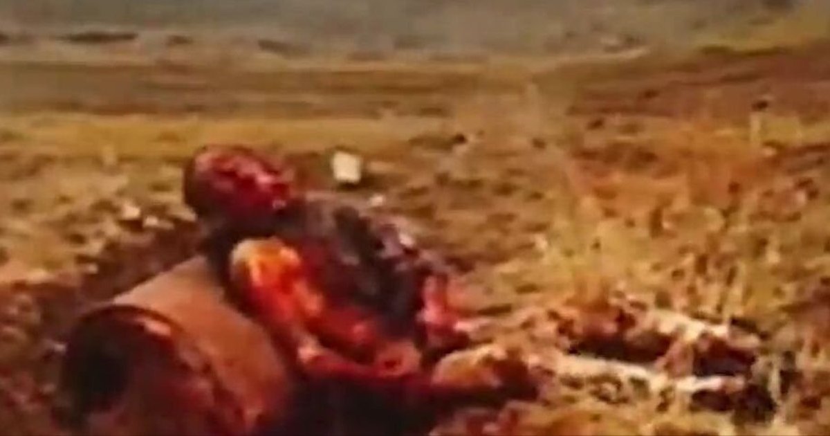 Burned Russian assault soldier waits for drone after attack on vehicle ...
