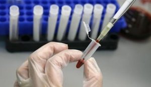 Кабмин упростил использование химических веществ для научных опытов