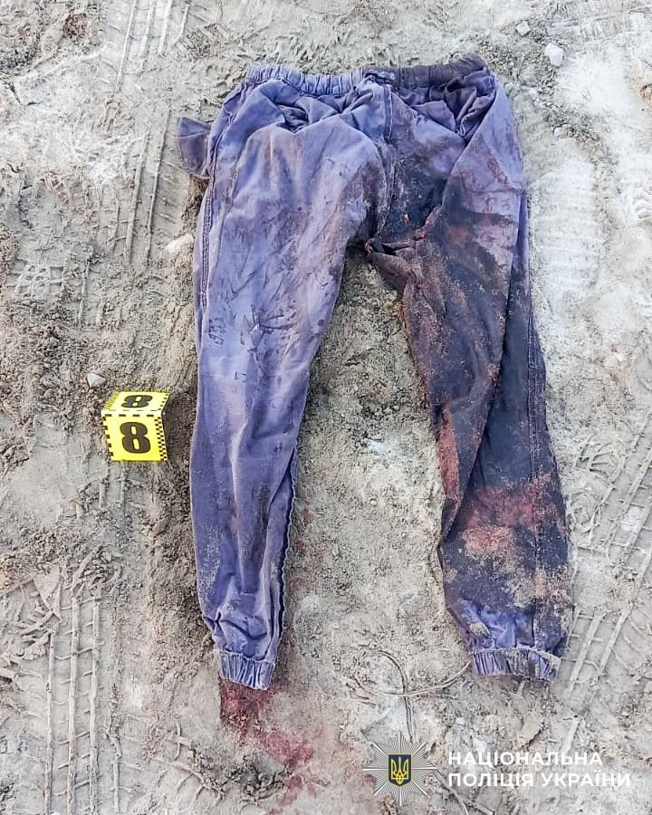 На Рівненщині затримали чоловіка, який поранив двох людей із рушниці