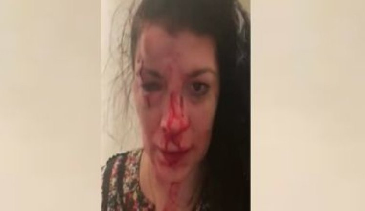 "Наріковська шобла намагається вбити мене. Якщо зі мною щось трапиться, прошу винним у цьому вважати Олександра Петровського", - двоє невідомих побили правозахисницю з Дніпра Ешонкулову. ВІДЕО 18+