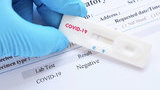 Stepanov comments on possible introduction of ‘vaccine passports’