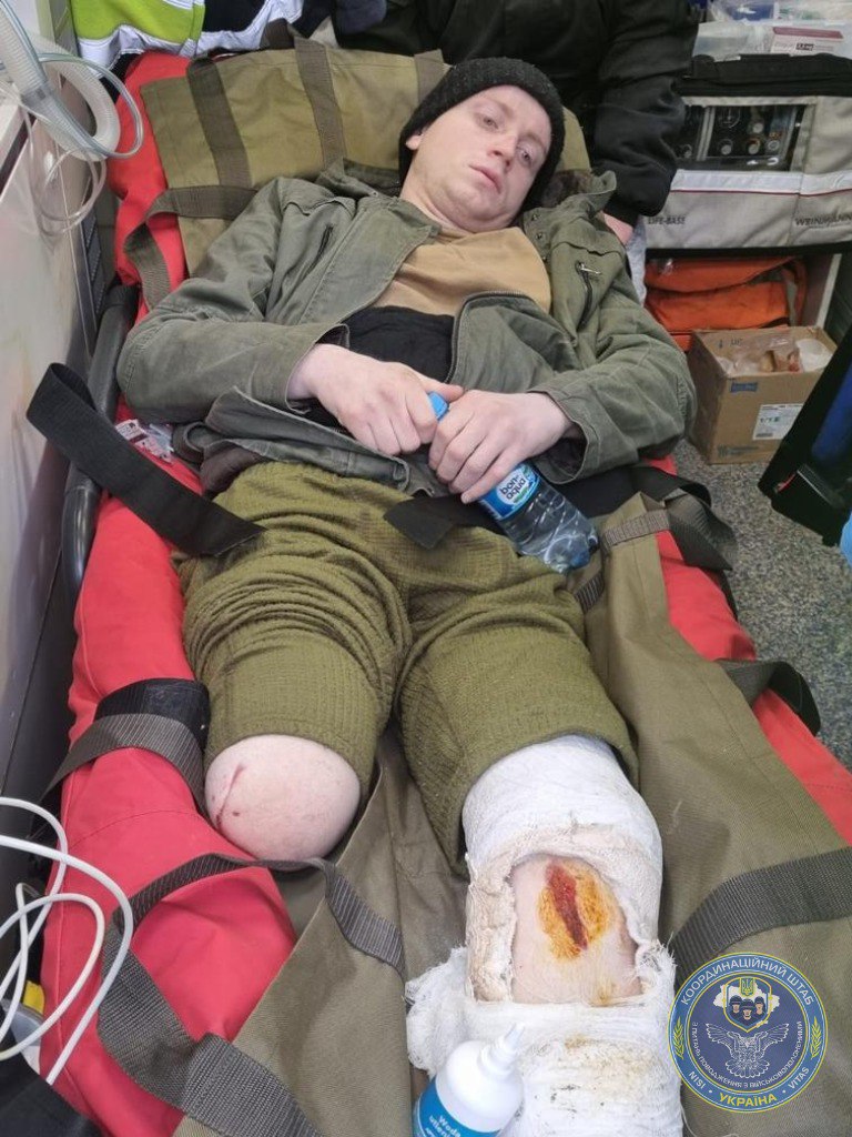 Ukraine unilaterally handed over to Russian Federation all severely wounded prisoners whose condition permitted transportation, - Coordination Headquarters 08