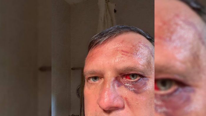 Окупанти 1,5 доби тримали в полоні старосту округу на Чернігівщині. Над чоловіком знущались, щоб отримати дані про розташування ЗСУ 03