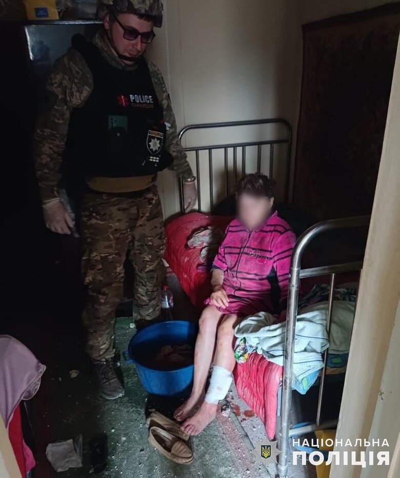 Consequences of enemy shelling of Donetsk region 02