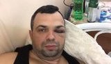 Суд починає розгляд справи про напад на адвоката Неділька на АЗС під Києвом