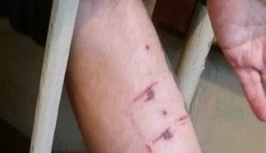 ДБР розслідує побиття ув'язнених у СІЗО Кропивницького