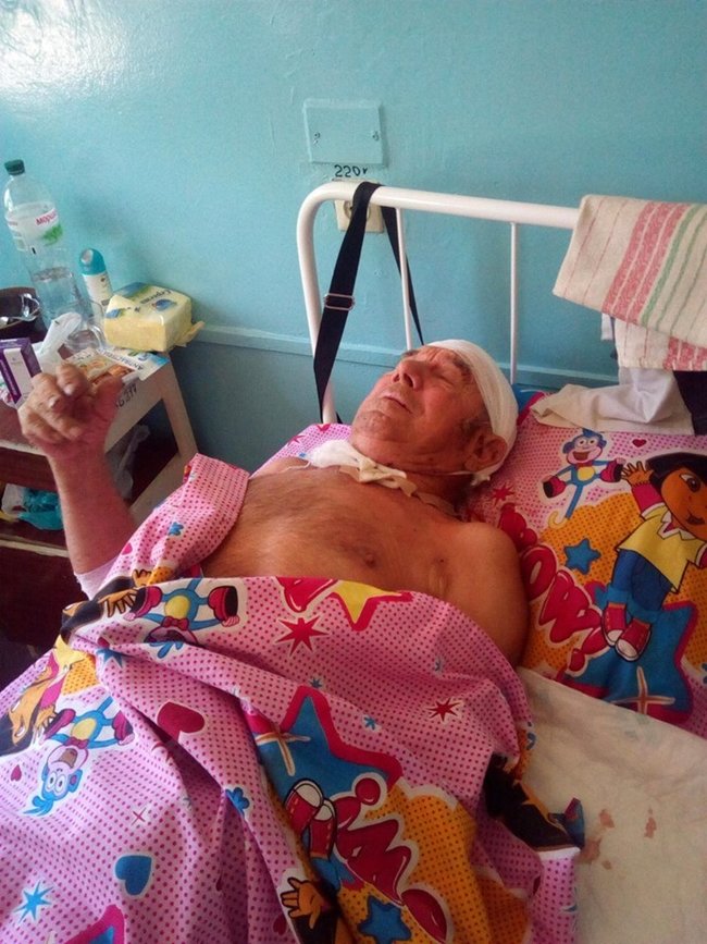 Терористи обстріляли Новгородське: унаслідок розриву 82-мм міни поранено мирного жителя, - СЦКК 02