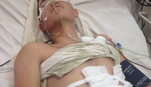 Gravely wounded Ukrainian soldier Vitalii delivered to Mechnykov hospital in Dnipro, - governor's adviser Huba. PHOTO