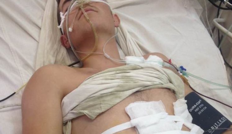 Gravely wounded Ukrainian soldier Vitalii delivered to Mechnykov hospital in Dnipro, - governor's adviser Huba. PHOTO