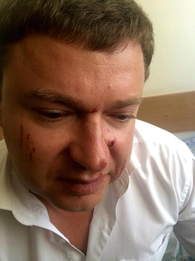 выборы одесса избиение горин