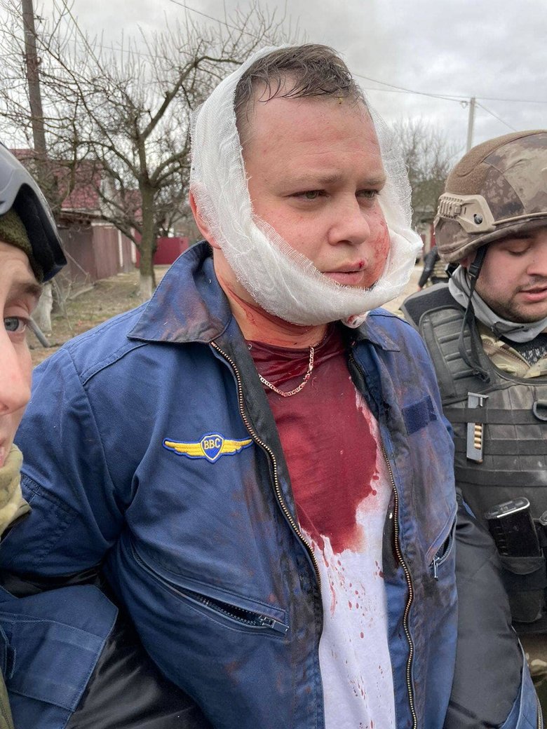 Одного з пілотів збитого у Чернігові російського СУ-25 затримано, другий - знищений 06 Одного з пілотів збитого у Чернігові російського СУ-25 затримано, другий - знищений 06