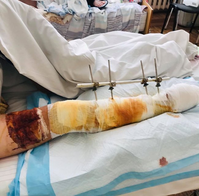 Пандемия, пожары и война - всем надо помогать: Волонтер Юсупова опубликовала отчеты и просит продолжать помогать воинам, медикам и пожарным 03