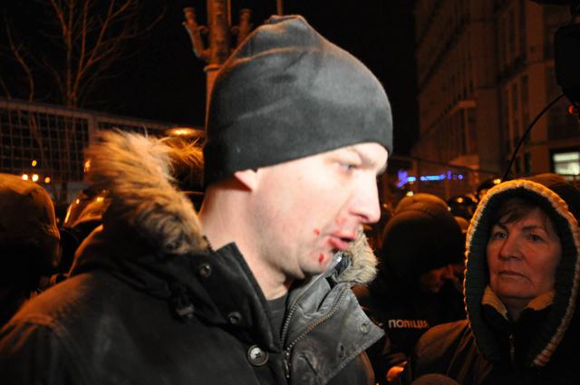 Полиция задержала главу "Добровольческого движения ОУН" Коханивского после потасовки между протестующими и правоохранителями 19