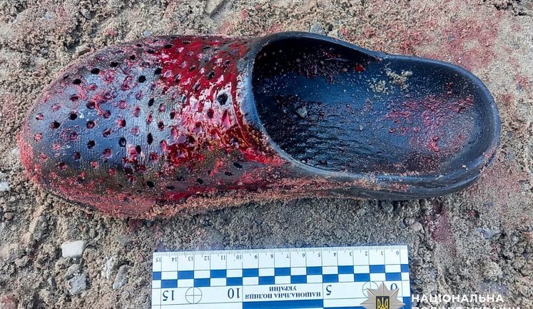 Побилися, а потім вчинили стрілянину: на Рівненщині двох чоловіків госпіталізували з вогнепальними пораненнями. ФОТО