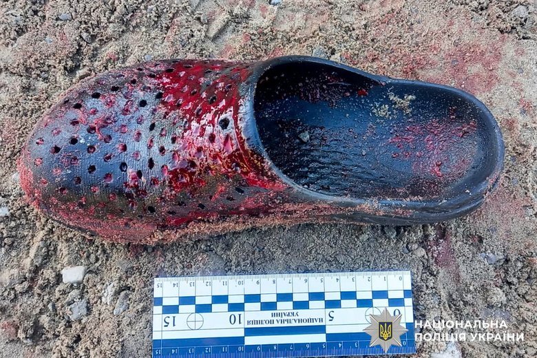 На Рівненщині затримали чоловіка, який поранив двох людей із рушниці