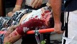 Теракт в России: 2 взрыва, до 20 погибших