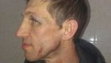 У МОН просять Авакова взяти під особистий контроль розслідування побиття вчителя фізкультури київського ліцею