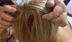 На главу депутатского объединения "Справедливость" Устинову в Раде упал дверной засов: ей вызвали скорую. ФОТОрепортаж