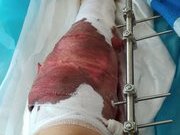 Эвакуация из Северодонецка