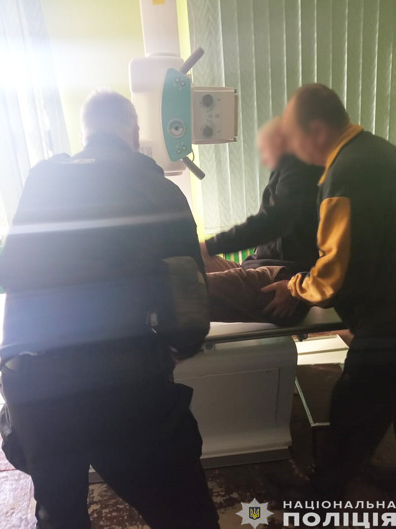 Поранений чоловік на Чернігівщині