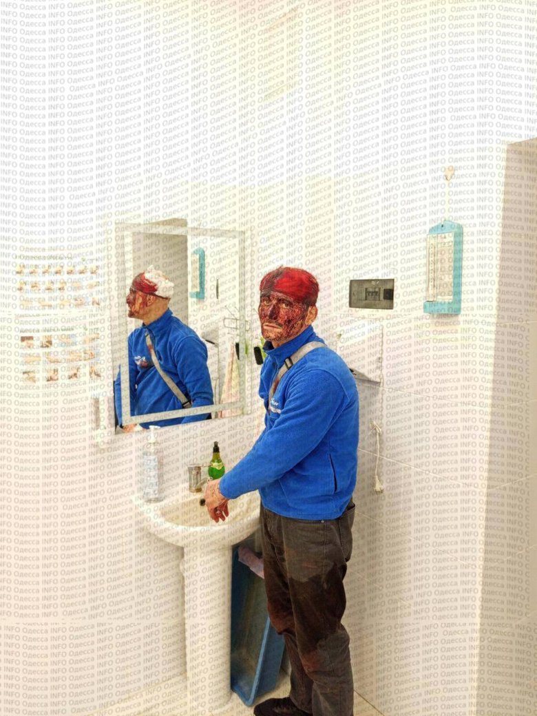 ТЦК в Одесі прокоментував фото чоловіка з травмою голови