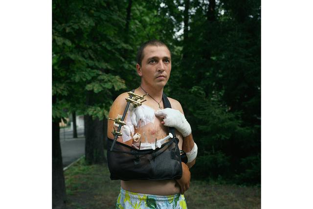 Проект українського фотографа Чекменьова зі знімками поранених воїнів зібрав близько $ 400000 для їх лікування і підтримки 19