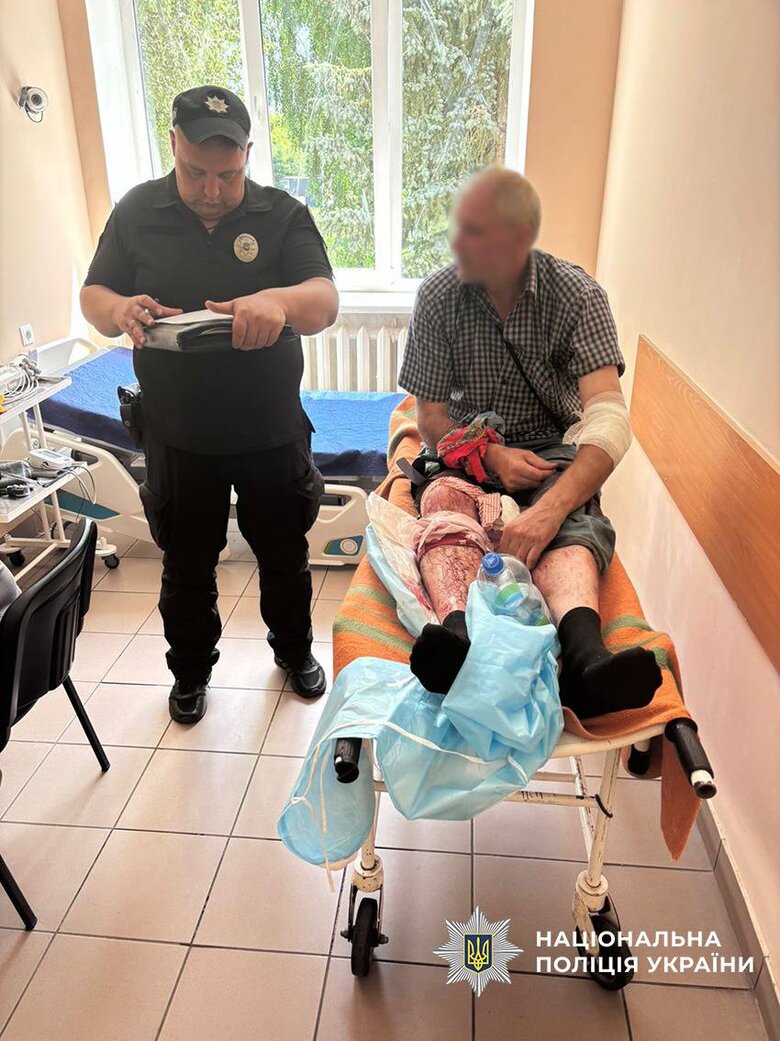 поранений чоловік на Чернігівщині